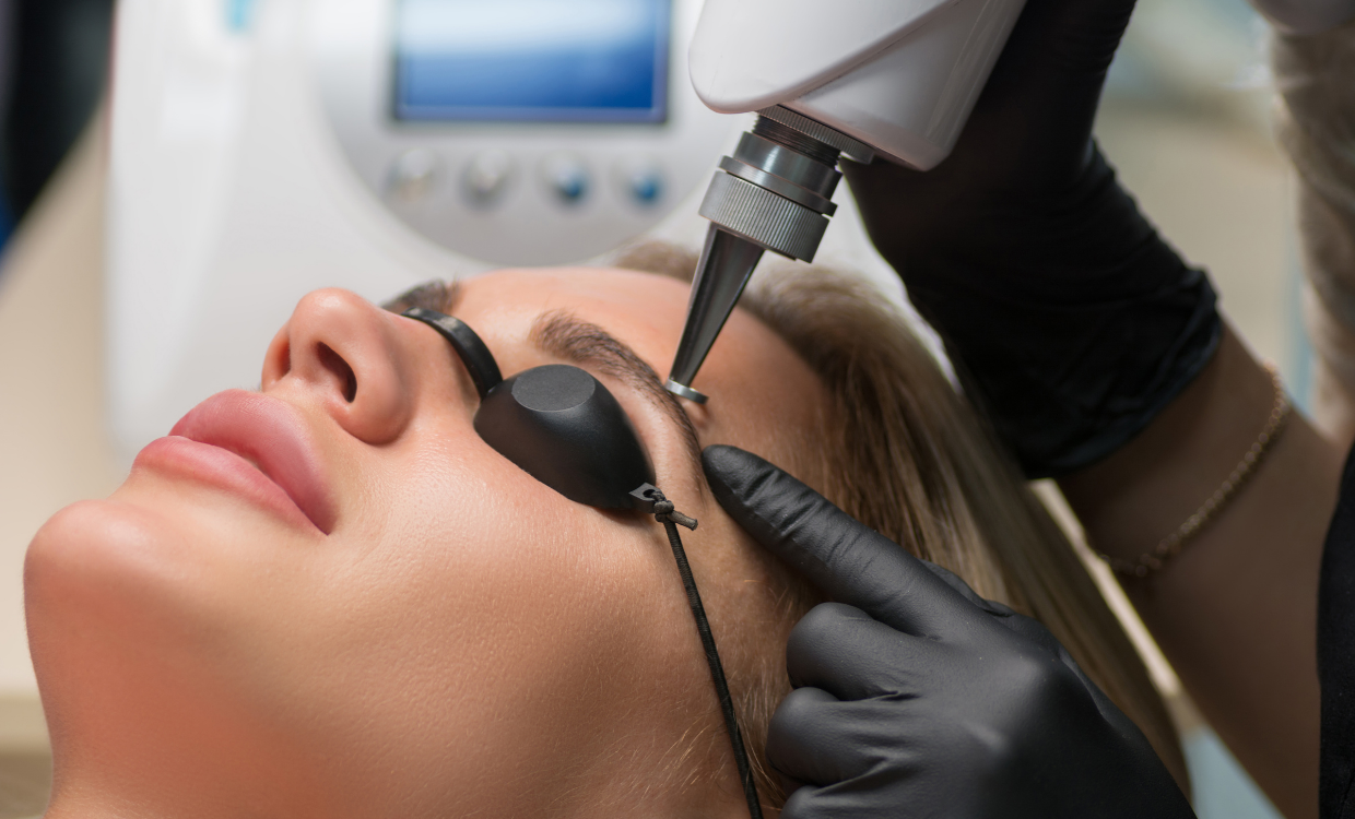 Kaş Silme İşlemi 2 DR. SIRIN CELIK BLOGLAR 12